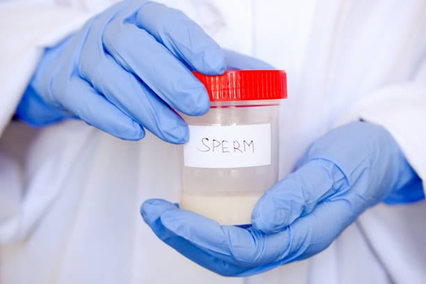 men sperm donation